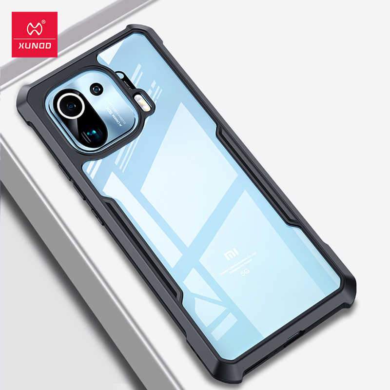 Funda Xundd para Xiaomi Mi 11 Smart Technology